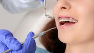 Teenage girl with dental braces visiting orthodontist in clinic