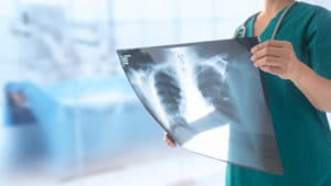 doctor radiology looking at chest x-ray film of patient at hospital.